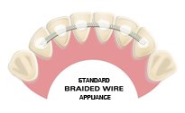 Appliance Lifetimelingual